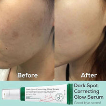Load image into Gallery viewer, AXIS-Y Dark Spot Correcting Glow Serum 50ml