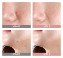 Load image into Gallery viewer, Mizon Good Bye Blemish Pink Spot 19ml