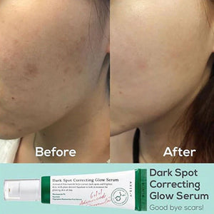 AXIS-Y Dark Spot Correcting Glow Serum 50ml